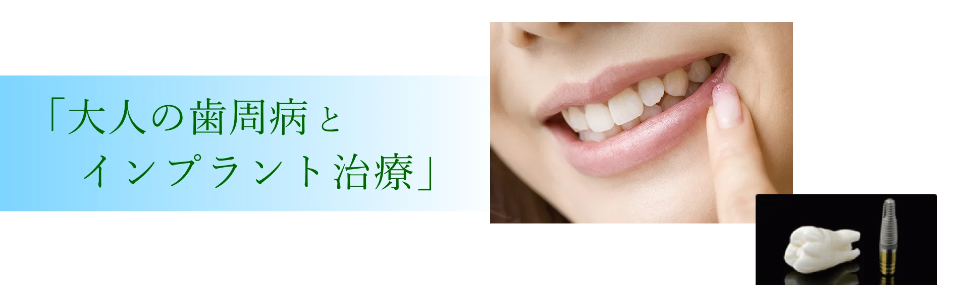 「大人の歯周病とインプラント治療」